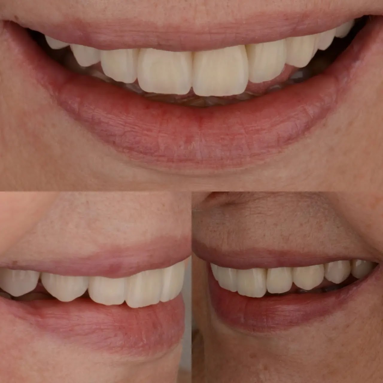Sonrisa trabajada en Clinica Gazzola