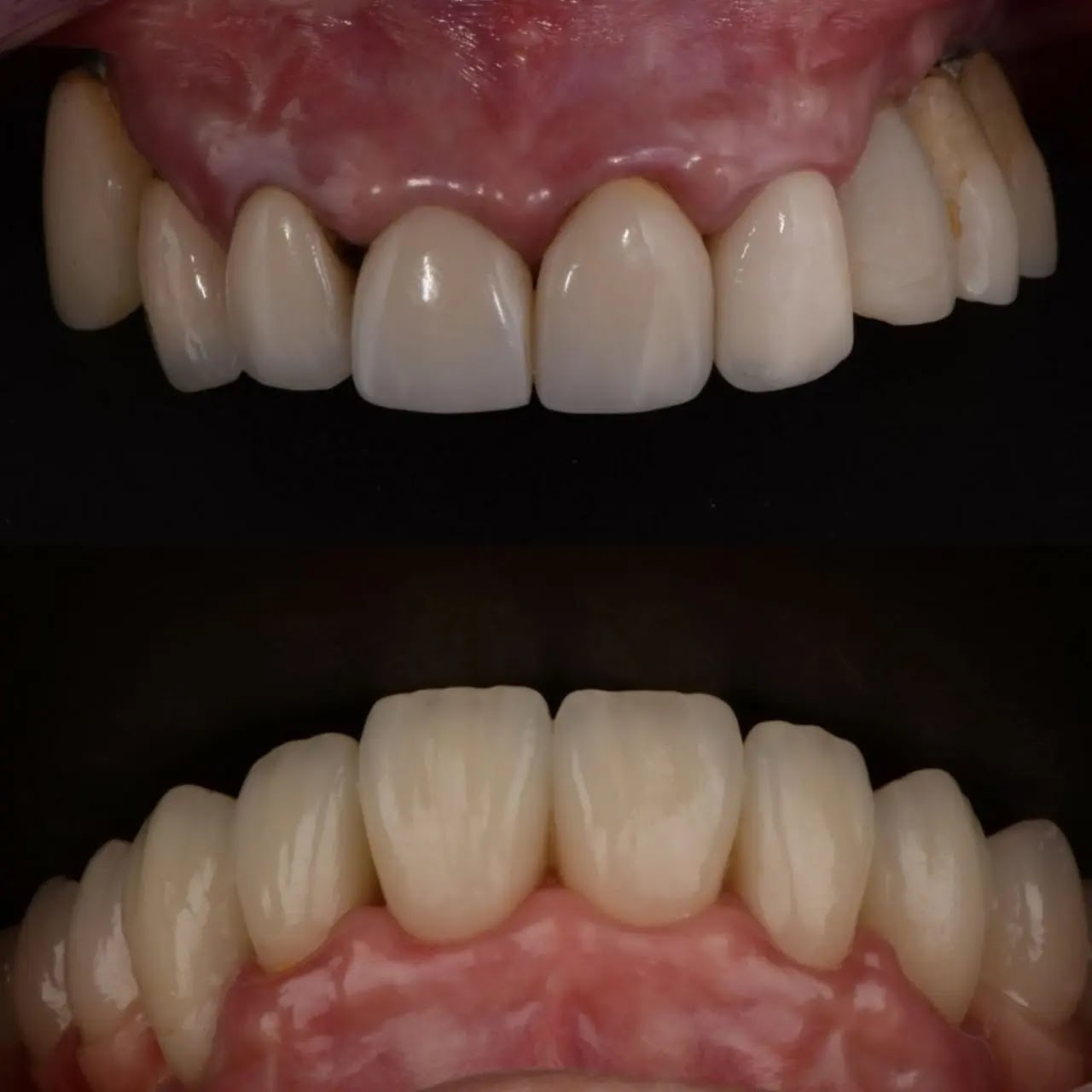 Trabajo odontológico Clinica Gazzola