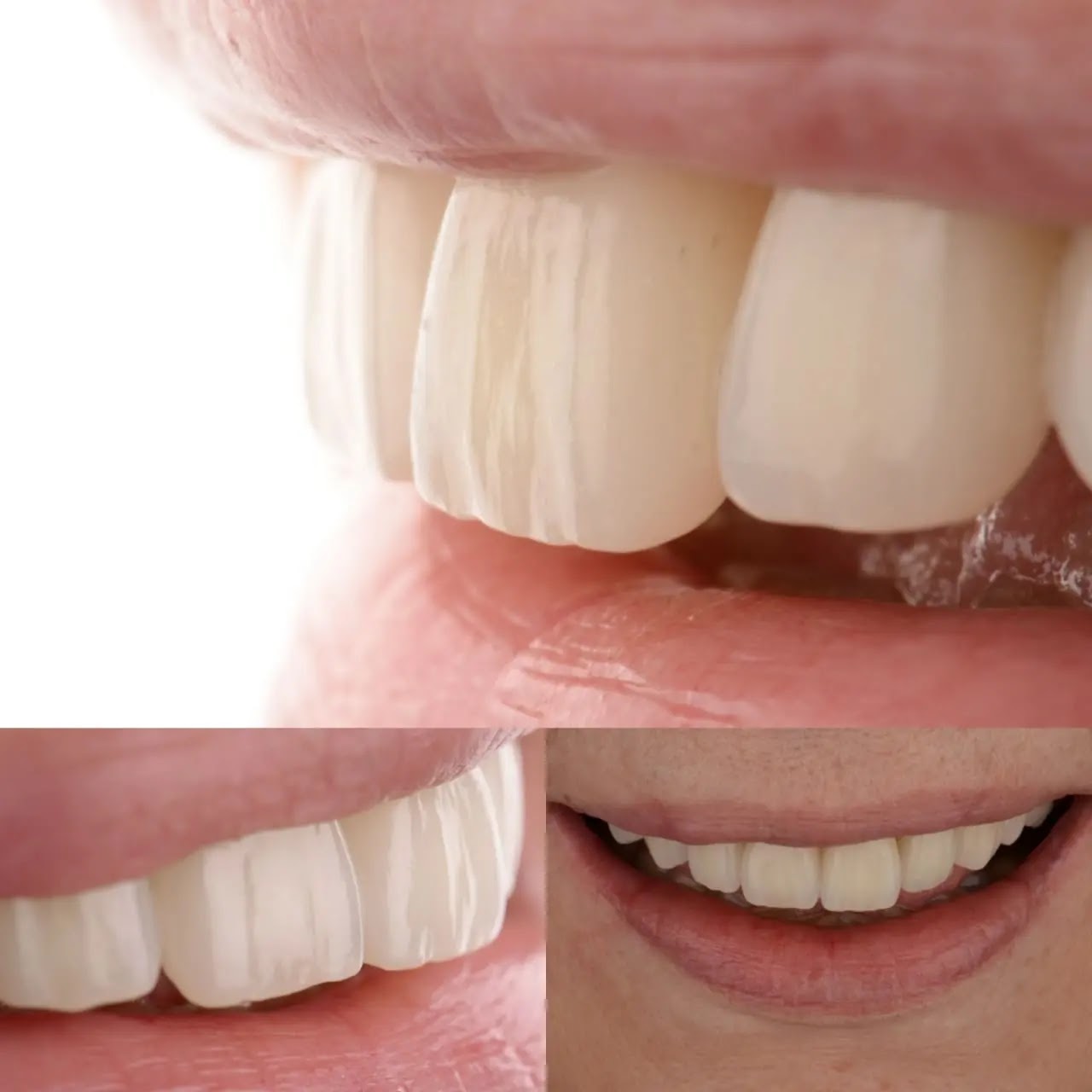 Trabajo odontológico Clinica Gazzola