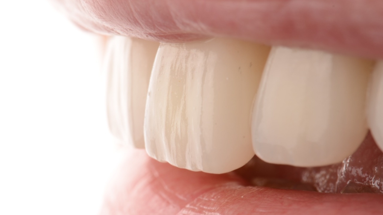 Trabajo odontológico Clinica Gazzola