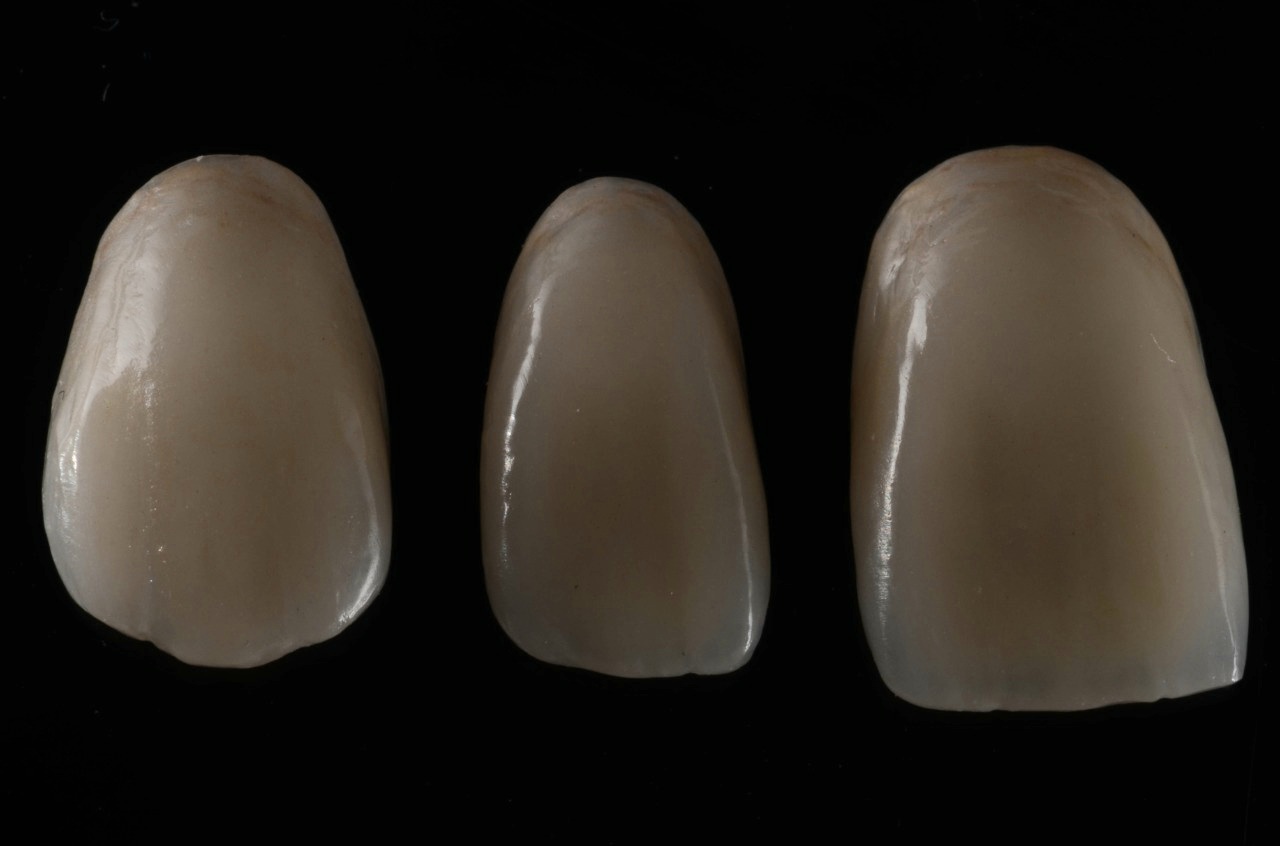 Trabajo odontológico Clinica Gazzola